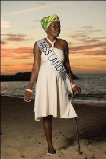 Un concours de beautés estropiées. 'Miss rescapée des mines'